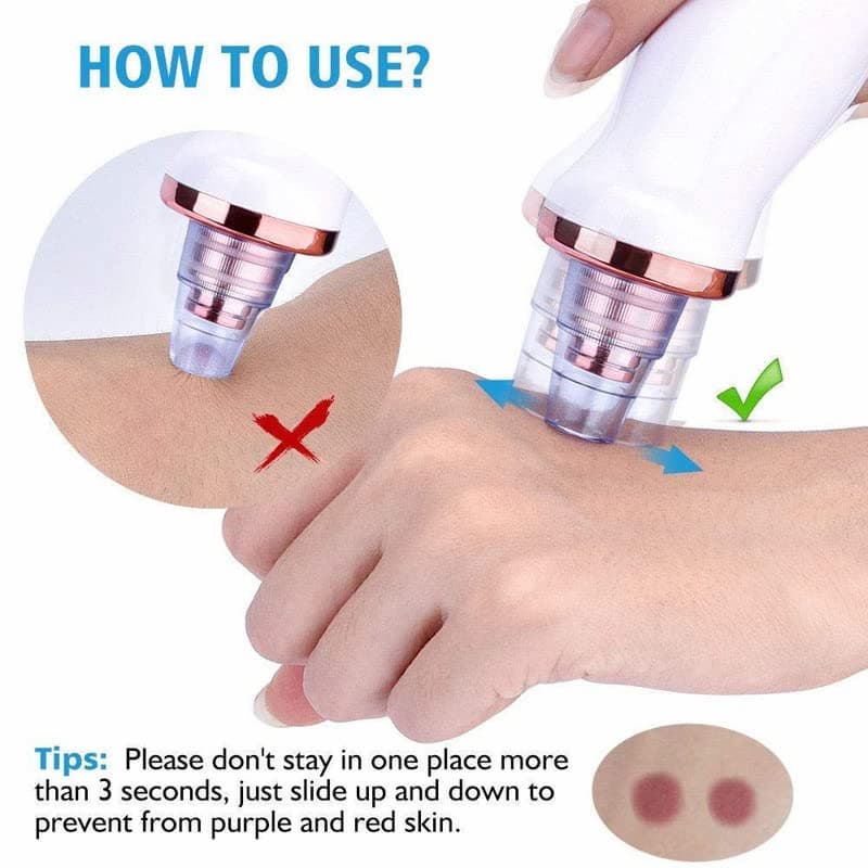⭐ DermaGlow™ 5-in-1 Acne & Blackhead Remover Pro Glower Steps