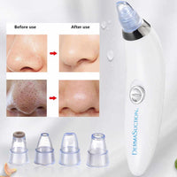 ⭐ DermaGlow™ 5-in-1 Acne & Blackhead Remover Pro Glower Steps
