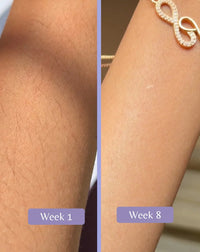 IPL Hair Removal Handset 🌸 Glower Steps