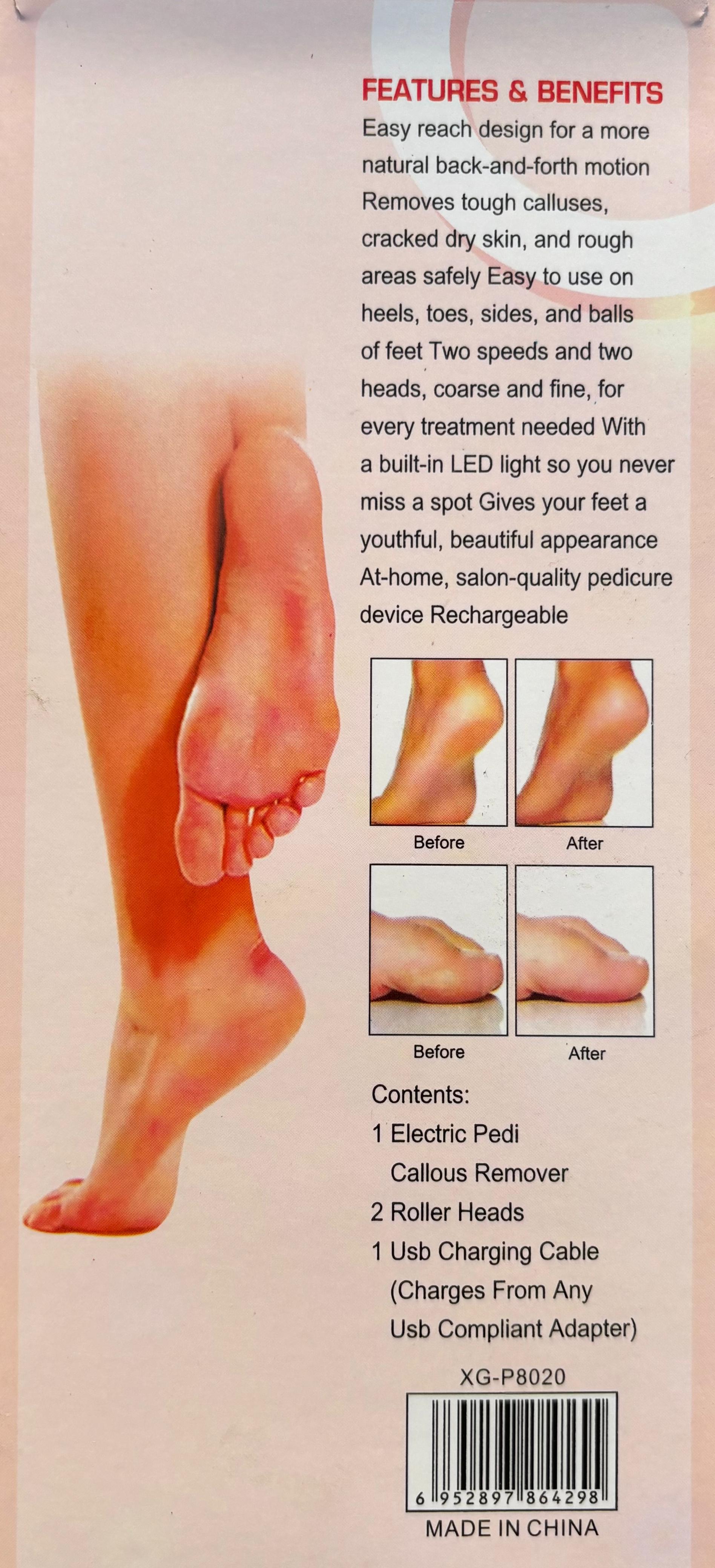 Callus Remover by Glower Steps